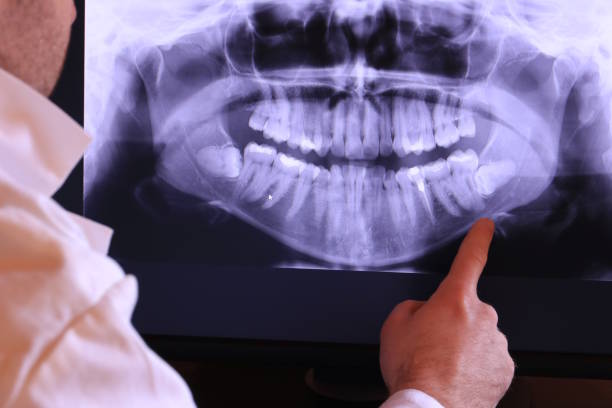 Best Tooth Pain Emergency Relief  in Chico, WA