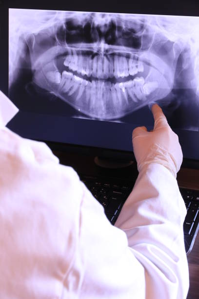 Best Cracked Tooth Emergency Dentist  in Chico, WA