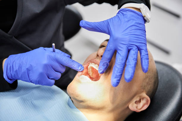 Best Emergency Gum Pain Relief  in Chico, WA